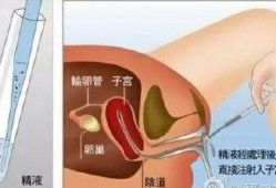 人工授精视频,科技助力生育新篇章